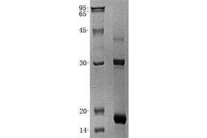Validation with Western Blot (ZNF100 Protein (His tag))