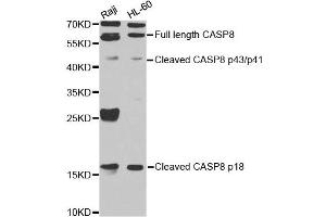 Western blot analysis of extracts of Raji cell and HL-60 cell line, using CASP8 antibody. (Caspase 8 Antikörper)
