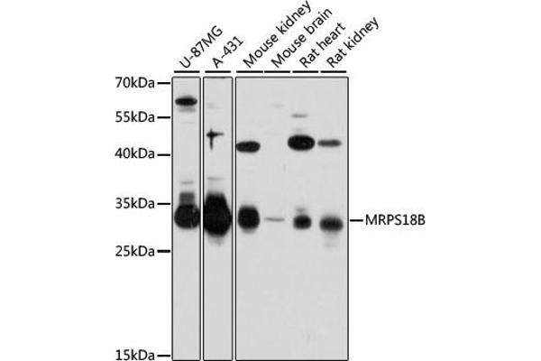 MRPS18B Antikörper  (AA 1-258)