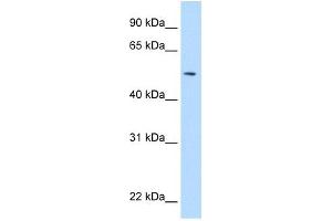 NEU1 antibody used at 5 ug/ml to detect target protein. (NEU1 Antikörper)