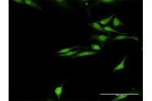 Immunofluorescence of purified MaxPab antibody to SNCG on HeLa cell. (SNCG Antikörper  (AA 1-127))