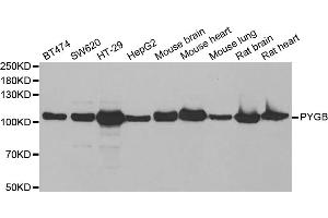 Western blot analysis of extracts of various cell lines, using PYGB antibody (ABIN5973803) at 1/1000 dilution. (PYGB Antikörper)