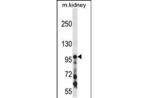 Western blot analysis in mouse kidney tissue lysates (35ug/lane). (COL1A1 Antikörper  (C-Term))