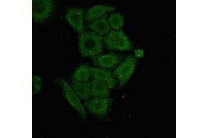 Immunofluorescent analysis of PC-3 cells using ABIN7166156 at dilution of 1:100 and Alexa Fluor 488-congugated AffiniPure Goat Anti-Rabbit IgG(H+L) (SSX1 Antikörper  (AA 112-188))