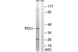 Western blot analysis of extracts from 293 cells, using PECI Antibody. (PECI/ECI2 Antikörper  (AA 73-122))
