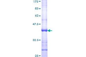 DIO2 Protein (AA 166-265) (GST tag)