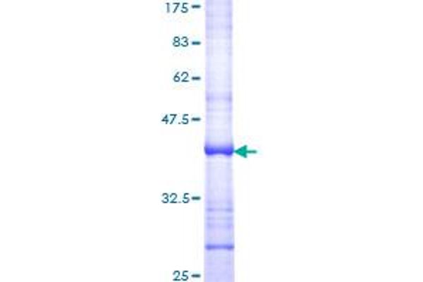 DIO2 Protein (AA 166-265) (GST tag)