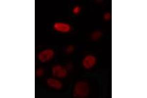 ABIN6274327 staining HuvEc cells by IF/ICC. (Nuclear Factor 1 Antikörper)