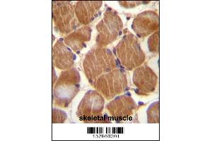 ASAM Antibody immunohistochemistry analysis in formalin fixed and paraffin embedded human skeletal muscle followed by peroxidase conjugation of the secondary antibody and DAB staining. (CLMP Antikörper  (AA 81-110))