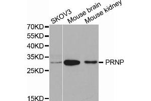 Western blot analysis of extracts of various cell lines, using PRNP antibody (ABIN5971407) at 1/1000 dilution. (PRNP Antikörper)