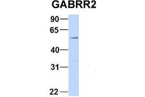 Host:  Rabbit  Target Name:  GABRR2  Sample Type:  293T  Antibody Dilution:  1. (GABRR2 Antikörper  (Middle Region))