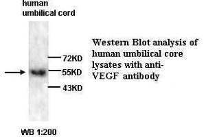 Western Blotting (WB) image for anti-Vascular Endothelial Growth Factor A (VEGFA) antibody (ABIN6583751) (VEGFA Antikörper)