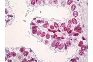 Immunohistochemistry (IHC) image for anti-H3 Histone, Family 3A (H3F3A) (AA 1-137) antibody (ABIN1498570)