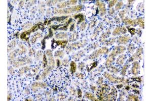 IHC analysis of CD2AP using anti-CD2AP antibody (ABIN6719544). (CD2AP Antikörper  (AA 253-337))