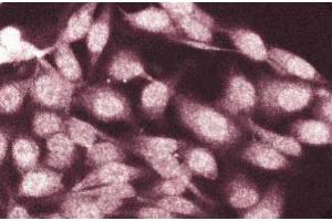 Immunofluorescence staining of HeLa cells. (CTNNA1 Antikörper  (AA 729-906))