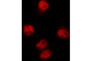 Immunofluorescence (fixed cells) (IF/ICC) image for anti-Heterogeneous Nuclear Ribonucleoprotein C (C1/C2) (HNRNPC) (pSer260) antibody (ABIN6256225)