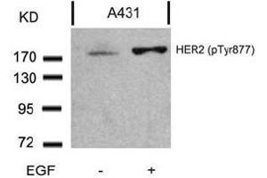 Image no. 3 for anti-Receptor tyrosine-protein kinase erbB-2 (ErbB2/Her2) (pTyr877) antibody (ABIN196748) (ErbB2/Her2 Antikörper  (pTyr877))