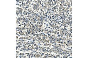 IHC analysis of LDLR using anti-LDLR antibody (ABIN7601438).