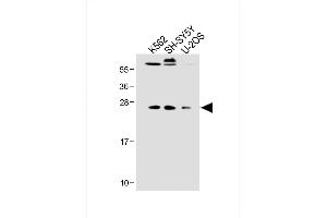 All lanes : Anti-N6T1 Antibody (N-term) at 1:2000 dilution Lane 1: K562 whole cell lysate Lane 2: SH-SY5Y whole cell lysate Lane 3: U-2OS whole cell lysate Lysates/proteins at 20 μg per lane. (N6AMT1 Antikörper  (N-Term))