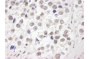 Immunohistochemistry (IHC) image for anti-Ubiquitin Interaction Motif Containing 1 (UIMC1) (C-Term) antibody (ABIN7449010) (UIMC1 Antikörper  (C-Term))
