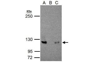 IP Image NFkB p100/p52 antibody immunoprecipitates NFkB p100/p52 protein in IP experiments. (NFKB2 Antikörper  (C-Term))
