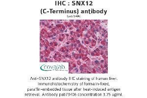 Image no. 1 for anti-Sorting Nexin 12 (SNX12) (C-Term) antibody (ABIN1739487)