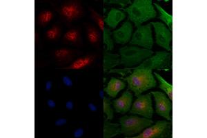 ABIN7094437 and ABIN7098485 staining  cells by IF/ICC. (STRA8 Antikörper  (Internal Region))
