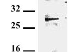 Detection of endogenous tollip in murine EL-4. (TOLLIP Antikörper)