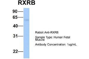 Host:  Rabbit  Target Name:  RXRB  Sample Type:  Human Fetal Muscle  Antibody Dilution:  1.