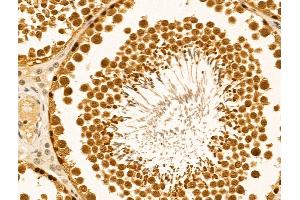 ABIN6261344 and ABIN6269035 at 1/100 staining Rat testis tissue by IHC-P. (DNMT3B Antikörper  (N-Term))