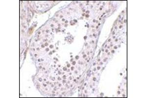 Immunohistochemistry of MED4 in human testis tissue with this product at 10 μg/ml. (MED4 Antikörper  (C-Term))