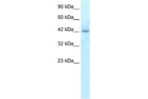 WB Suggested Anti-RGS20 Antibody Titration:  5. (RGS20 Antikörper  (N-Term))