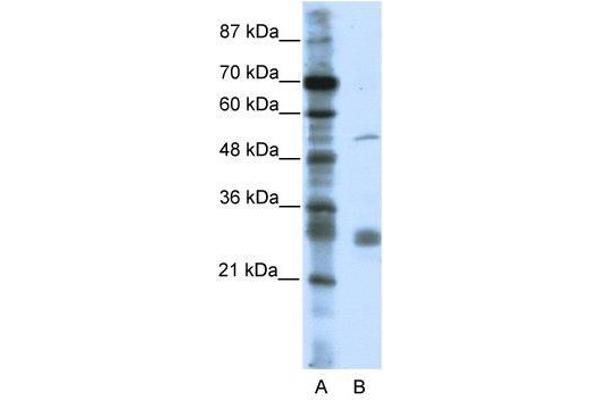 LRRC14 Antikörper  (C-Term)