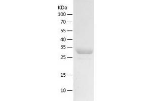 Western Blotting (WB) image for Transcription Elongation Factor A (SII), 3 (TCEA3) (AA 1-299) protein (His tag) (ABIN7287292) (TCEA3 Protein (AA 1-299) (His tag))