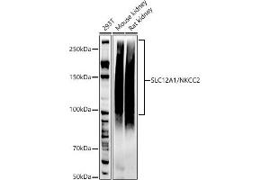 Western blot analysis of extracts of various cell lines, using SLC12/NKCC2 antibody (ABIN7270400) at 1:1000 dilution. (SLC12A1 Antikörper)