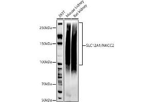 Western Blotting (WB) image for anti-Solute Carrier Family 12 (Sodium/potassium/chloride Transporters), Member 1 (SLC12A1) antibody (ABIN7270400)