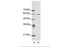 Image no. 1 for anti-AT Rich Interactive Domain 3A (BRIGHT-Like) (ARID3A) (AA 339-388) antibody (ABIN6736104) (ARID3A Antikörper  (AA 339-388))