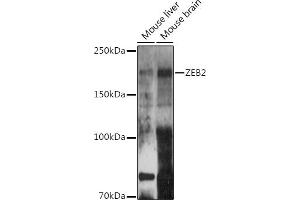 Western blot analysis of extracts of various cell lines, using ZEB2 antibody (ABIN6131480, ABIN6150424, ABIN6150425 and ABIN6221369) at 1:500 dilution. (ZEB2 Antikörper  (AA 1050-1214))