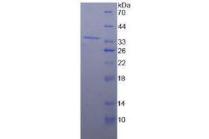 SDS-PAGE analysis of Human Nucleoporin 98 kDa Protein. (NUP98 Protein)