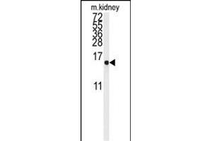 Western blot analysis of anti-LSM1 Antibody (Center) (ABIN389387 and ABIN2839482) in mouse kidney tissue lysates (35 μg/lane). (LSM1 Antikörper  (AA 33-61))