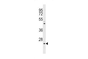 The anti-NeuroG1 N-term Pab  is used in Western blot to detect NeuroG1 in  cell lysate. (Neurogenin 1 Antikörper  (N-Term))