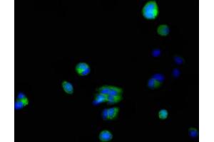 Immunofluorescent analysis of MCF-7 cells using ABIN7156155 at dilution of 1:100 and Alexa Fluor 488-congugated AffiniPure Goat Anti-Rabbit IgG(H+L) (FKBP6 Antikörper  (AA 101-327))