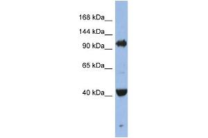WB Suggested Anti-EIF2C4 Antibody Titration: 0. (AGO4 Antikörper  (Middle Region))