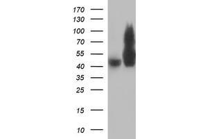 Image no. 1 for anti-Tubulin, beta 2B (TUBB2B) antibody (ABIN1501573) (TUBB2B Antikörper)