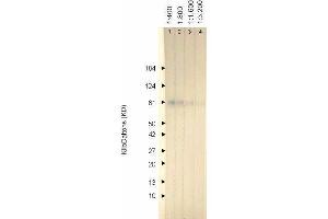 Western Blotting (WB) image for anti-Herpes Simplex Virus Type 1, Glycoprotein C (HSV1 gC) antibody (ABIN265557) (HSV-1 gC Antikörper)