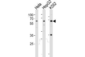 Western blot analysis of lysates from Hela, HepG2, K562 cell line (from left to right), using RIOK3 Antibody (Center) (ABIN6243990 and ABIN6577652). (RIOK3 Antikörper  (AA 146-179))