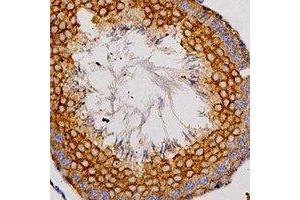 Immunohistochemical analysis of Adenosine A2a Receptor staining in human testis formalin fixed paraffin embedded tissue section. (Adenosine A2a Receptor Antikörper  (C-Term))