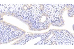 Detection of NFE2L2 in Rat Uterus Tissue using Polyclonal Antibody to Nuclear Factor, Erythroid Derived 2 Like Protein 2 (NFE2L2)