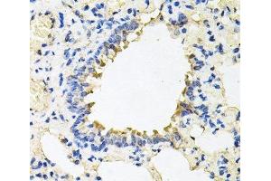 Immunohistochemistry of paraffin-embedded Rat lung using CALU Polyclonal Antibody at dilution of 1:100 (40x lens). (CALU Antikörper)