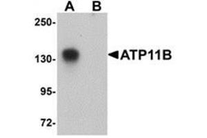 Western blot analysis of ATP11B in K562 cell tissue lysate with ATP11B antibody at 1 μg/ml in (A) the absence and (B) the presence of blocking peptide.